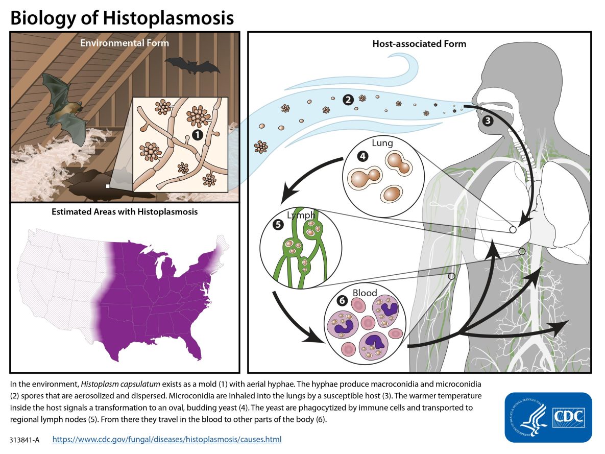 intro01 Illustration with text: In the environment, Histoplasma capsulatum exists as a mold with aerial hyphae. The hyphae produce macroconidia and microconidia spores that are aerosolized and dispersed. Microconidia are inhaled into the lungs by a susceptible host. The warmer temperature inside the host signals a transformation to an oval, budding yeast. The yeast are phagocytized by immune cells and transported to regional lymph nodes. From there they travel in the blood to other parts of the body.