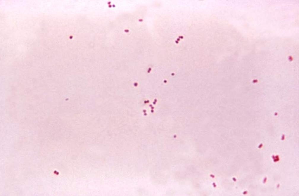 intro02 A microscopic view of Neisseria meningitidis bacteria, stained red. The bacteria are very small in the image and have a two-sphered shape.