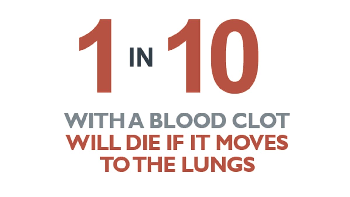 1-in-10-blood-clots.png 1 in 10 with a blood clot will die if it moves to the lungs