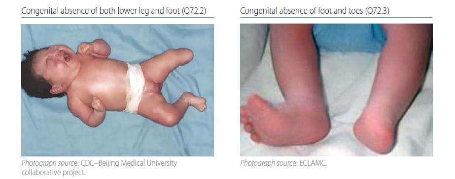 Fig. 4.37. Transverse terminal-pt2 Fig. 4.37. Transverse terminal-pt2