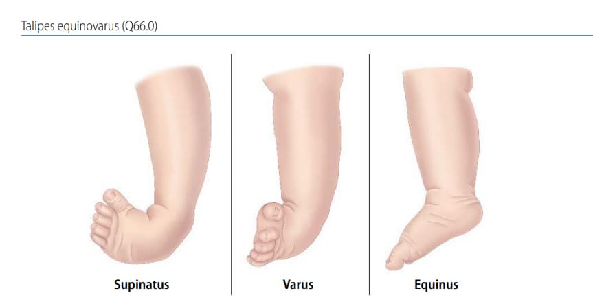 Fig.4.34.Footpositions Fig. 4.34. Foot positions