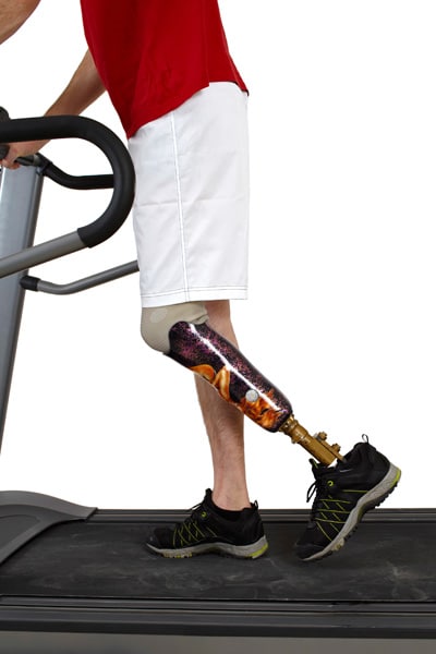 man-prosthetic-treadmill-400px.jpg Man with a prosthetic leg walking on a treadmill