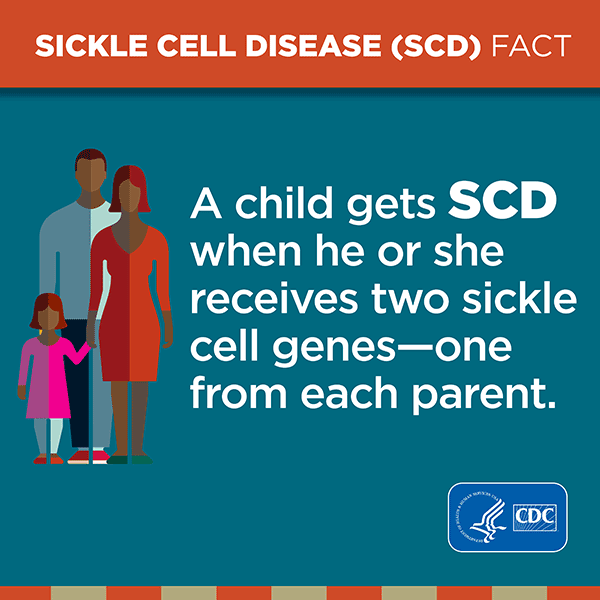 sickle-cell-parents-sq.png Sickle Cell Disease (SCD) Fact. A child gets SCD when he or she receives two sickle cell genes – one from each parent.