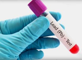 blood sample labeled for lead test Gloved hands holding a vial showing label for Lead (Pb) Test