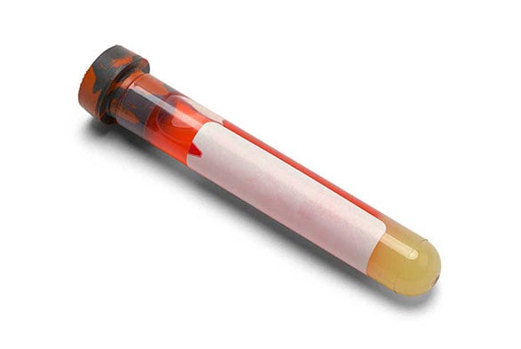 Labs perform dengue tests to determine current and past infections with dengue.
