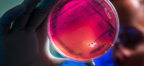 A scientist holding an infection in a dish