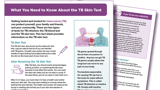 skinTestingInformationfactsheet.jpg TB Skin Test Infographic