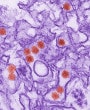 This is a digitally-colorized transmission electron micrograph (TEM) of Zika virus, which is a member of the family Flaviviridae. Virus particles, here colored red, are 40 nm in diameter, with an outer envelope, and an inner dense core.