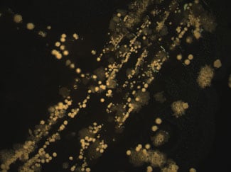 mixed-with-nocardia-colonies-present-bcye-35c-325 Mixed culture on buffered charcoal yeast extract agar 5 days at 35C, 0.63X. Suspect Nocardia colonies are visible as round, white fuzzy colonies each surrounded by a halo of substrate mycelium.