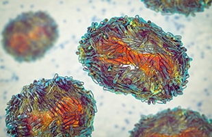 monkey pox microscope image enhanced monkey pox microscope image enhanced