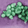 h1n1-100px.jpg An image of a negative stained electron micrograph of the H1N1, swine flu virus.