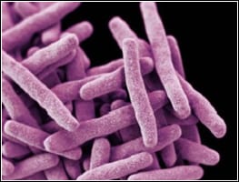 ORIGIN_img_TB Highly magnified photo of tuberculosis