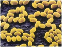 ORIGIN_img_ANTHRAX1 Highly magnified photo of Anthrax