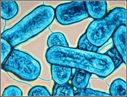 ORIGIN_img_LEGION2 Highly magnified photo of Legionnaire's Disease