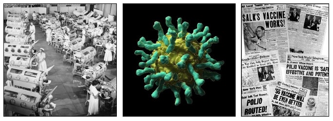 ORIGIN_img_POLIO Photos of polio virus, newspaper headlines of the day, and sick bay full of Polio patients.