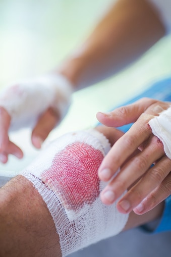 Image of a scraped knee with a bandaid being applied.