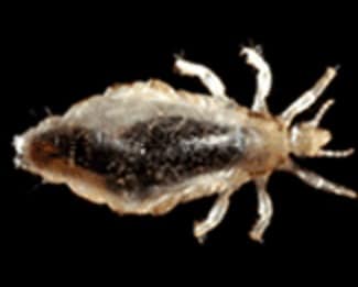 Body Lice