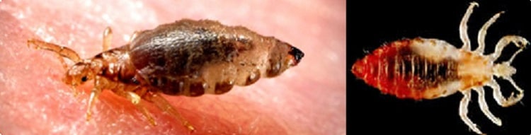 two adult body lice