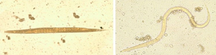 Image: Left: Adult free-living female S. stercoralis. Notice the row of eggs within the female's body. Right: Filariform (L3) larva of S. stercoralis in an unstained wet mount.