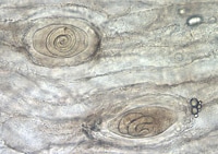 partially_digested_tspiralis