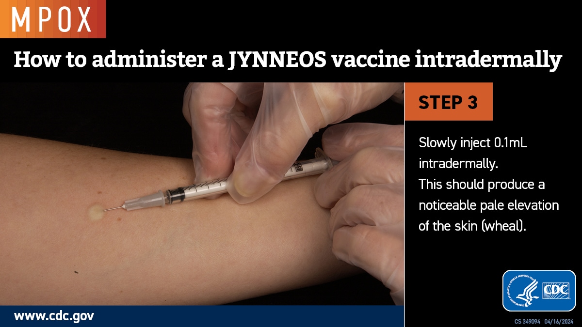 How to administer a Jynneos vaccine intradermally