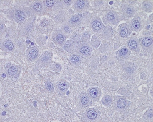 Negative IHC Imaging showing negative IHC