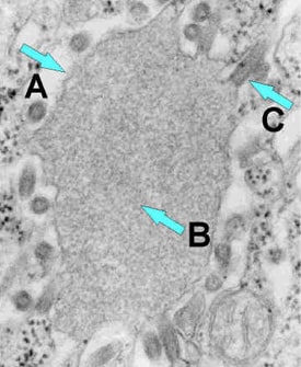 budding.jpg Electron microscope image of rabies virus budding from an inclusion into the endoplasmic reticulum in a nerve cell