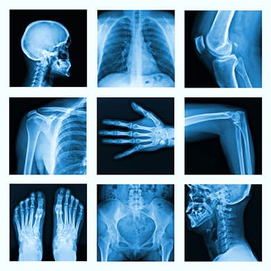 Several x-rays of a skull, ribs, joints, feet, and a pelvis.
