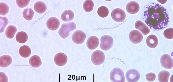 tbrf-smear.jpg Tick-borne Relapsing Fever spirochetes