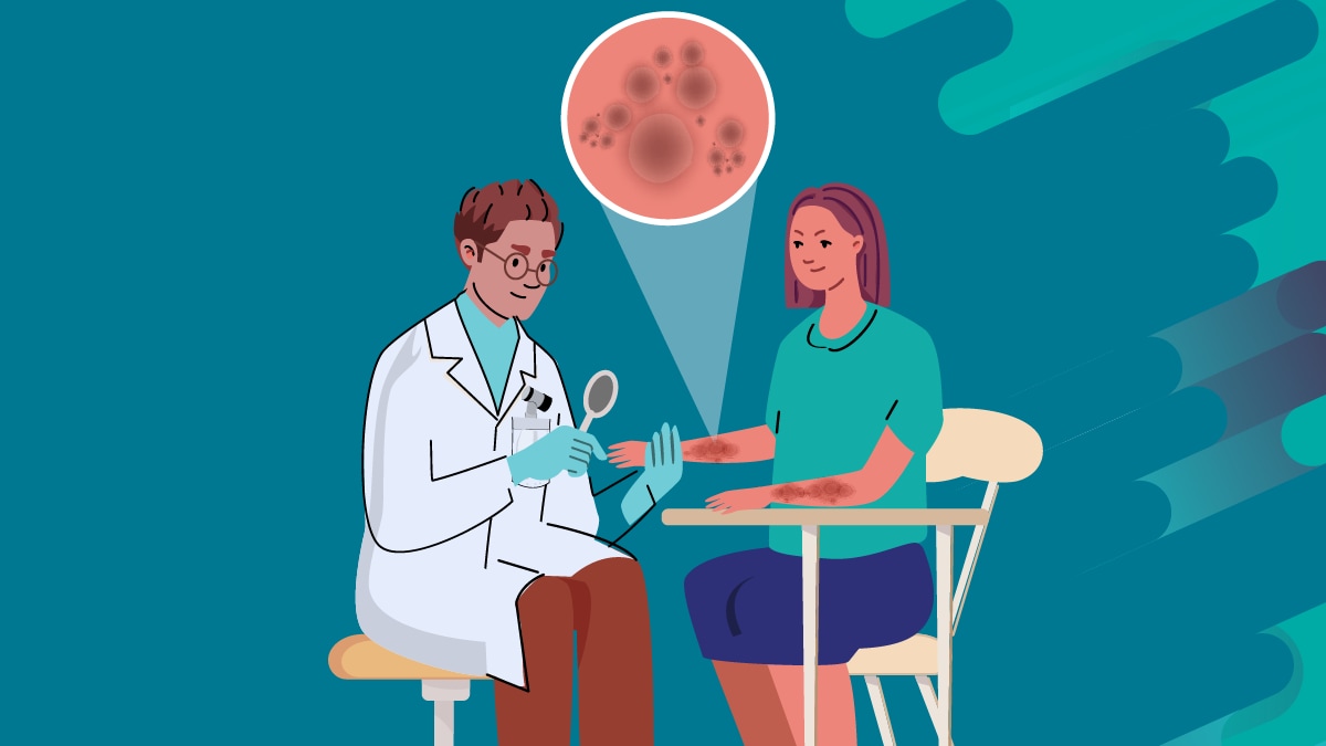 Examining ringworm Doctor examining skin for ringworm