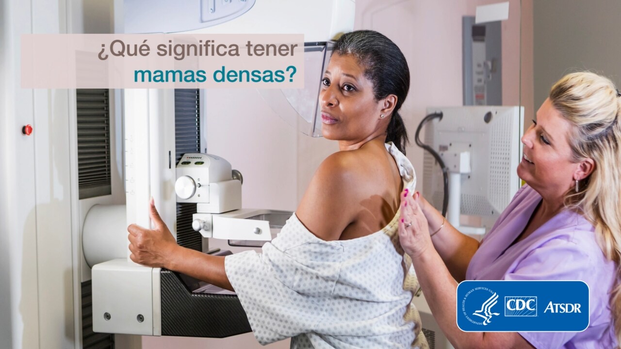 ¿Qué significa tener mamas densas?