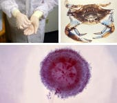 Tres cosas que causan sensibilización al asma guantes de látex, cangrejo, y fungi Aspergillus niger