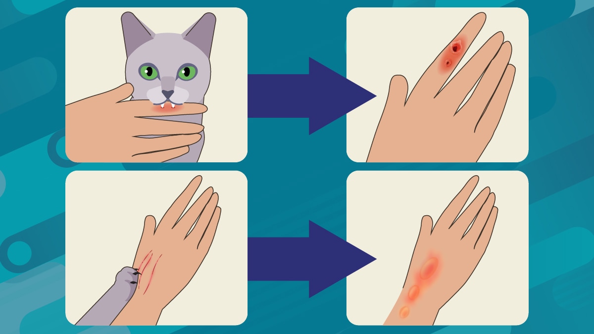 Cat scratches and scrapes can cause sporotrichosis An illustration showing a cat scratching and biting a hand.