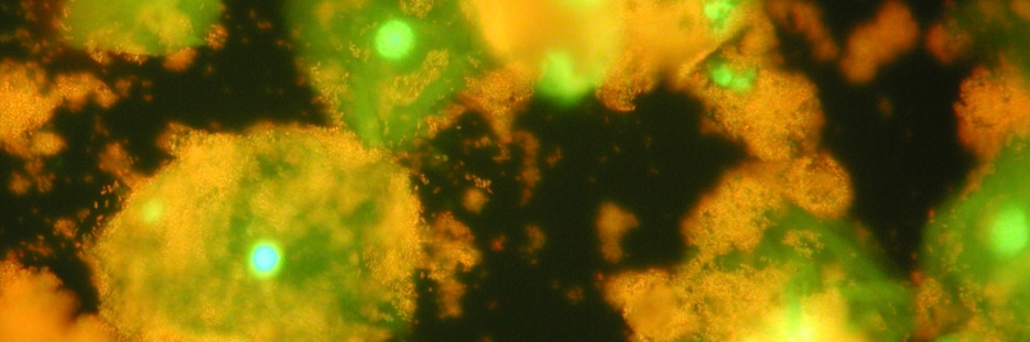 Any woman can get BV. Any woman can get BV