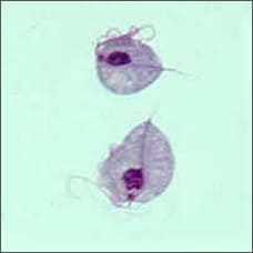 Two Trichomonas vaginalis parasites, magnified (seen under a microscope) Two Trichomonas vaginalis parasites, magnified (seen under a microscope)