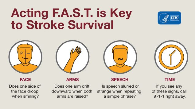 Acting F.A.S.T. is key to stroke survival.