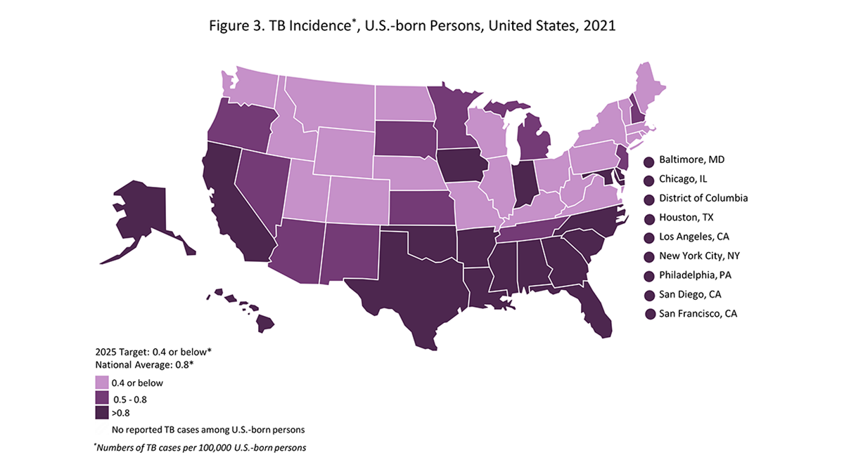 Figure 3: TB Incidence Among U.S.-born Persons in the United States, 2021 A map depicting TB Incidence Among U.S.-born Persons in the United States in 2021