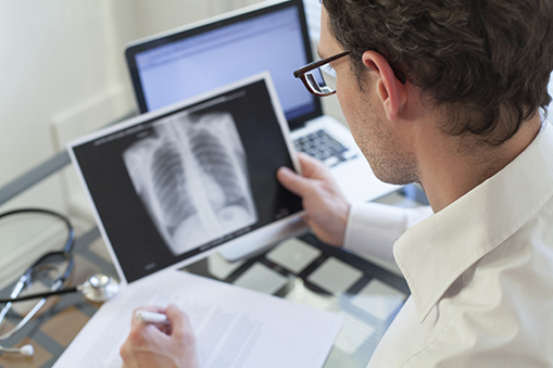 doctor looking at x-ray of lungs and writing diagnosis doctor looking at x-ray of lungs and writing diagnosis