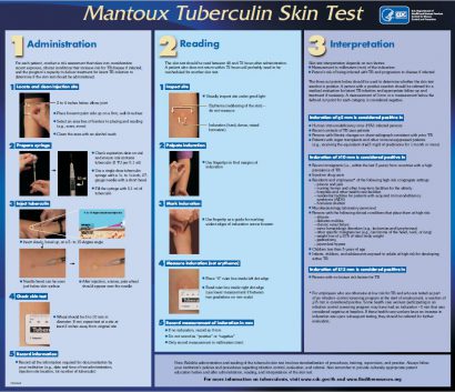 wall chart
