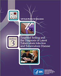 3 Module 3: Targeted Testing and the Diagnosis of Latent Tuberculosis Infection and Tuberculosis Disease