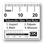 TB Ruler