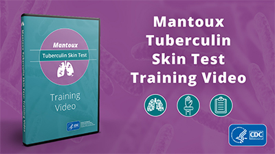 Mantoux_SkinTesrRuler.png SkinTesrRuler.png