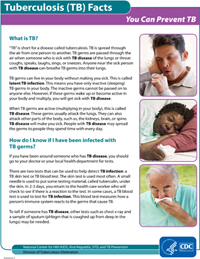 You Can Prevent TB Fact Sheets PDF file