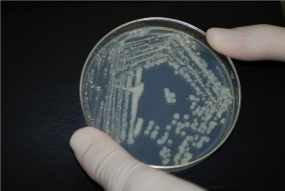 disc sample in petri dish