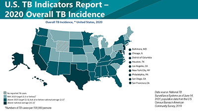 Overall-Incidence 2020 State and City Tuberculosis Report