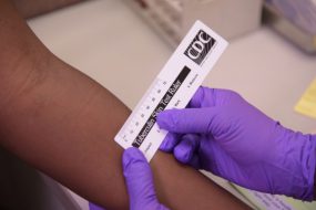 TB-SkinTest TB-SkinTest