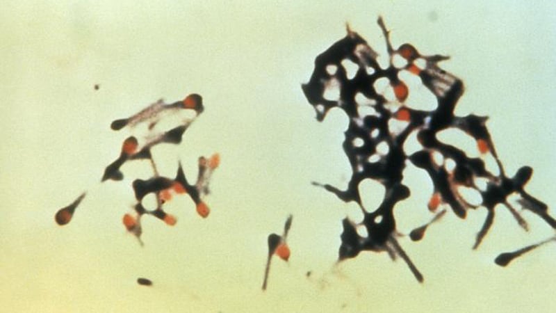 Tetanus Clostridium tetani bacteria cause tetanus.