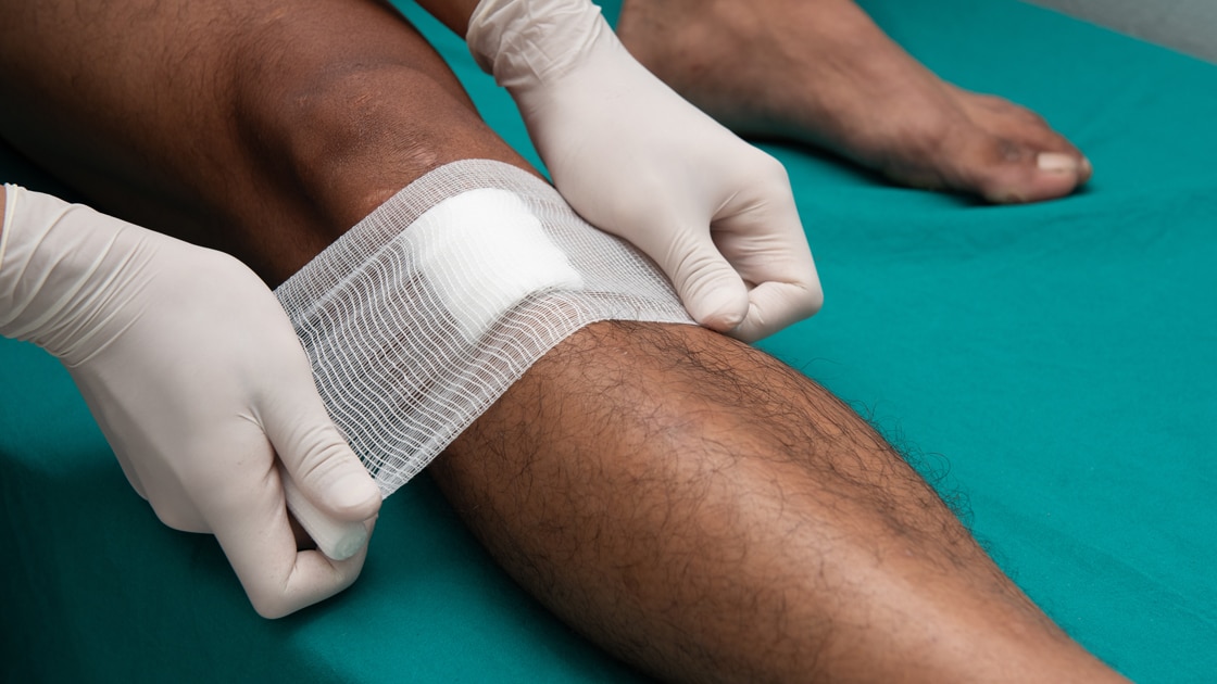 — title missing — Healthcare professional bandaging a knee