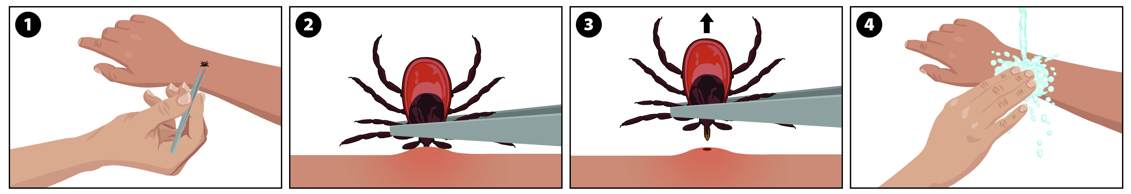 Illustration showing how to remove a tick (Ixodes scapularis pictured).