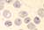 peripheral blood smear